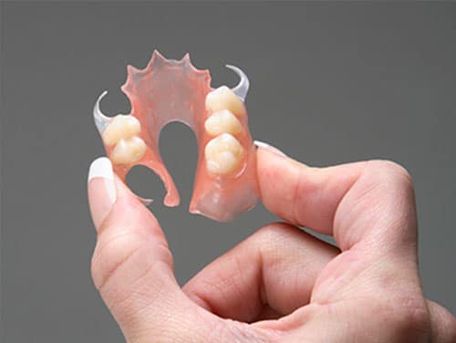 flexible partial dentures